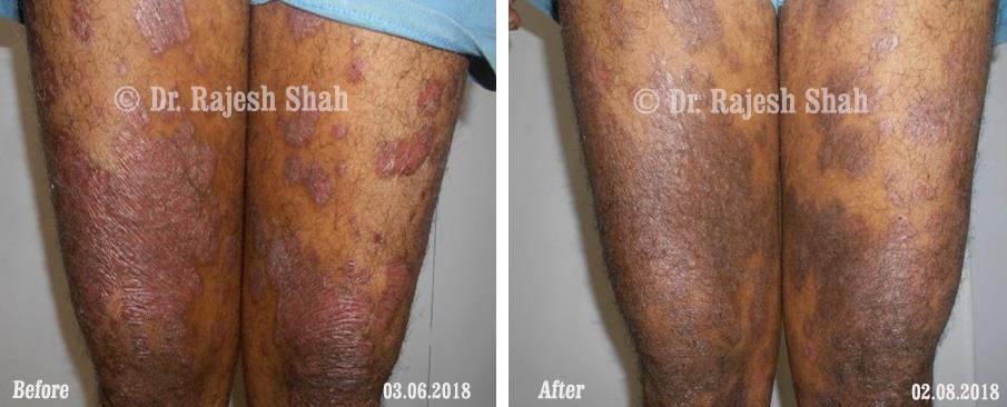 lifeforce homeopathy case-photos